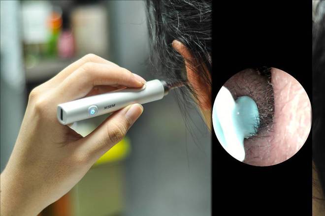 吗？挖耳勺到底怎么选？十大品牌测评分享！pg电子模拟器免费版带摄像头的挖耳勺好用(图9)
