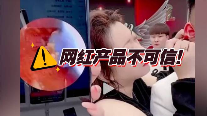 吗？挖耳勺到底怎么选？十大品牌测评分享！pg电子模拟器免费版带摄像头的挖耳勺好用(图8)